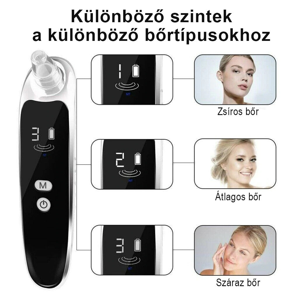 Pórustisztító készülék, Mitesszer Eltávolító, Mélytisztító